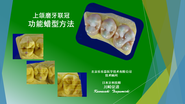 41xuE-BD4JL.jpg_BO30,255,255,