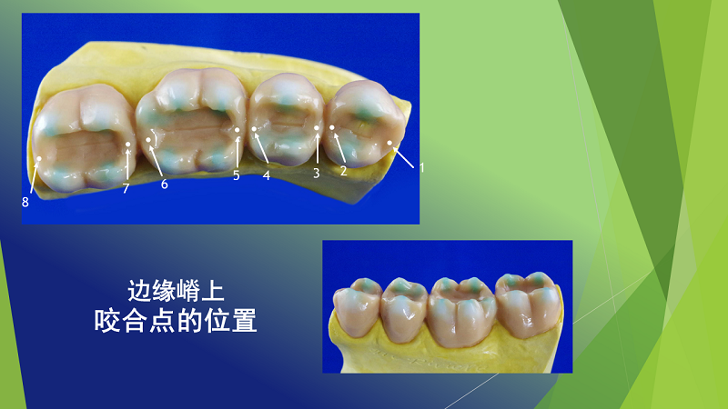 石膏棒を用いた歯型彫刻を一切行わない実習生のための基礎訓練